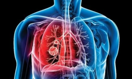 ¿Cómo se transmite la tuberculosis y cuáles son los síntomas?